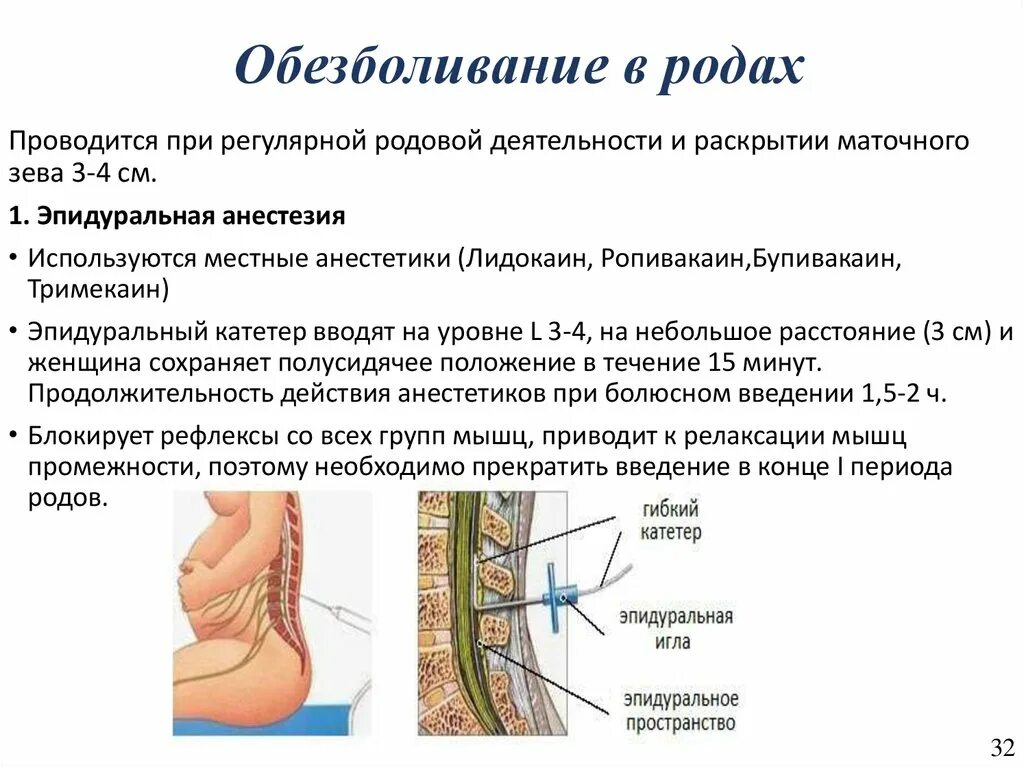 После кесарева болит поясница. Эпидуральная анестезия как делают. Эпидуральная анестезия при родах. Спинальная и эпидуральная анестезия. Эпидуральная анестезия и роды.