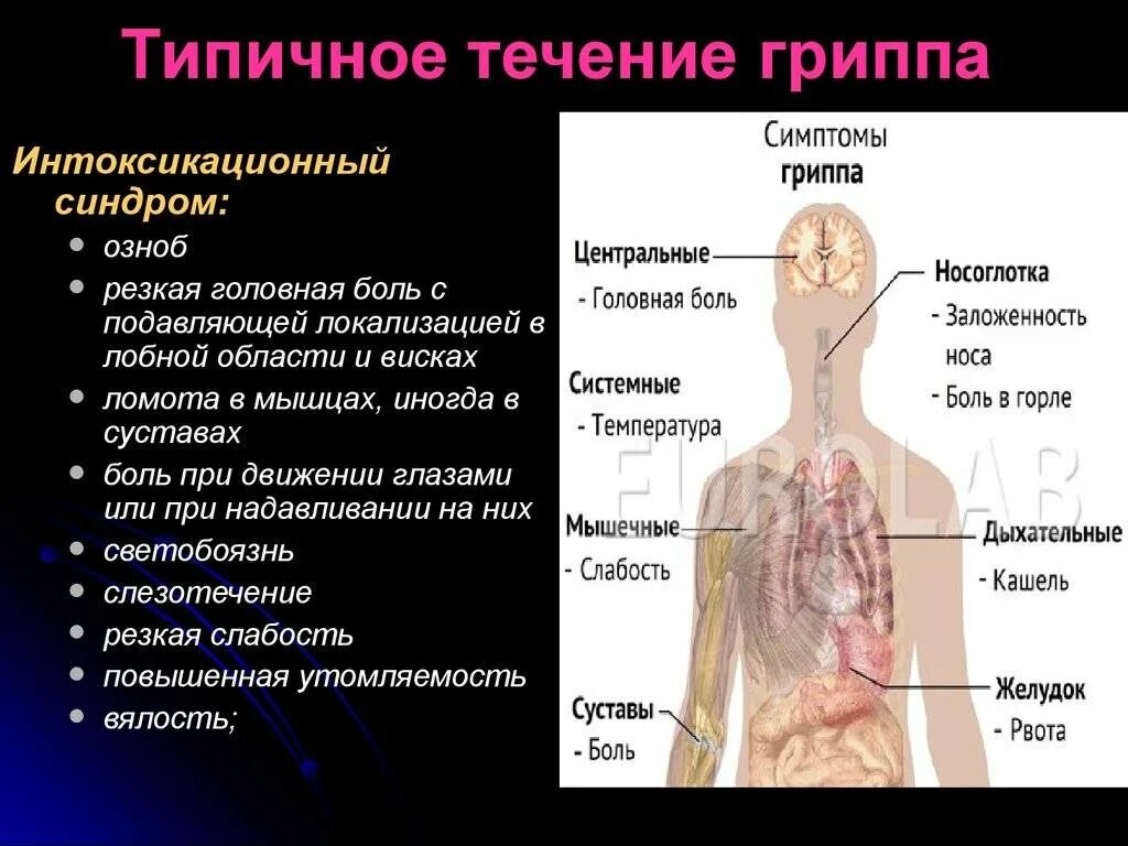 Характерные признаки гриппа. Симптомы гриппа. Основные симптомы гриппа. Основные симптомы и синдромы гриппа. Специфические симптомы гриппа.