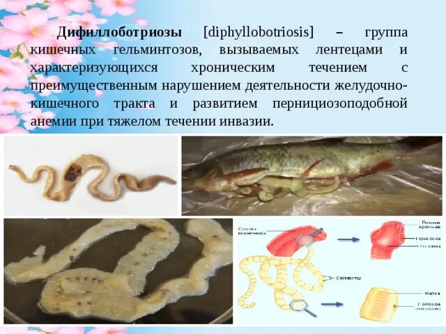 Широкий лентец образ жизни. Широкий лентец профилактика заболевания. Широкий лентец вызывает заболевание. Широкий лентец вызывает заболевание. Широкий лентец вызывает заболевание.