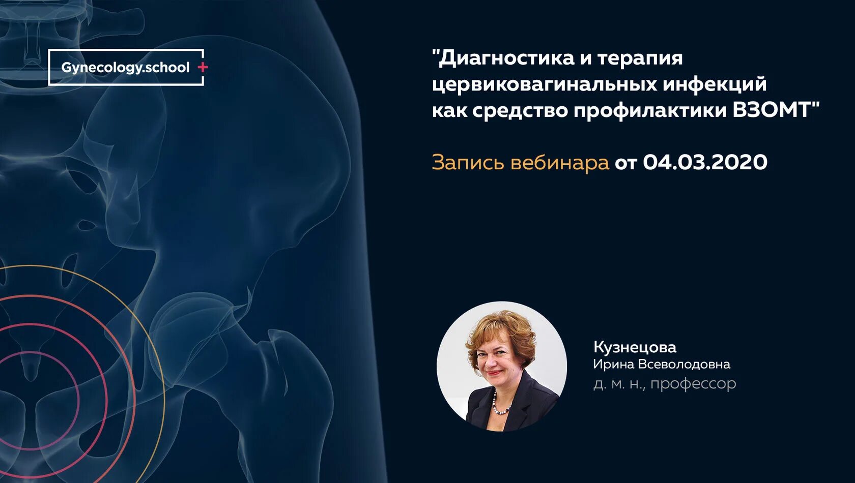 Воспалительные заболевания органов малого таза. Воспалительные заболевания органов малого таза клинические рекомендации. Неспецифические заболевания органов малого таза. Взомт клинические рекомендации. Методы диагностики взомт.