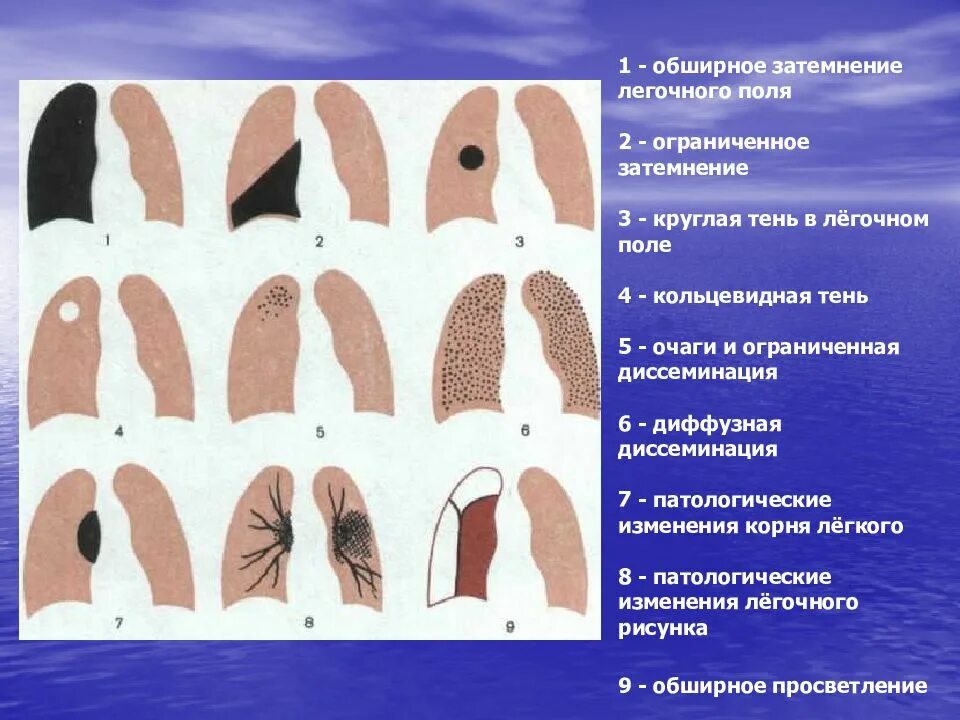 Округлое затемнение