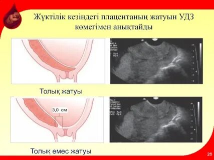 Катя Самбука минет порно
