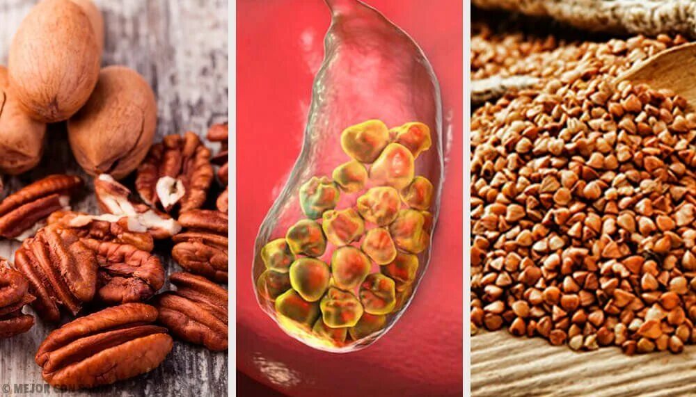 Орехи при удаленном желчном. Семечки и орехи при панкреатите. Лещина, грецкий орех, кедровый орех;. Фрукты и овощи при желчекаменной. Горсть грецких орехов.