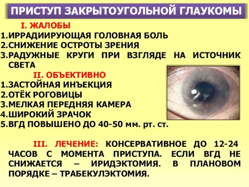 Глаукома лечение у взрослых. Первичная закрытоугольная глаукома. Приступ закрытоугольной глаукомы. Острый приступ открытоугольной глаукомы. Клиника закрытоугольной глаукомы.