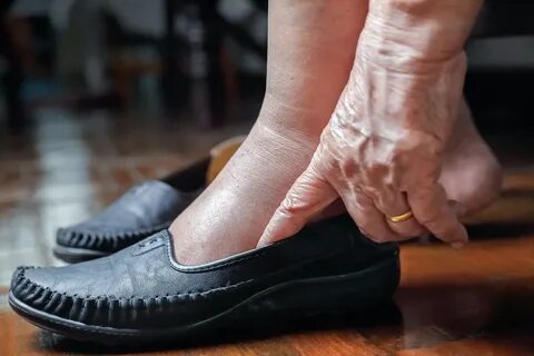 Под какую ногу ложат