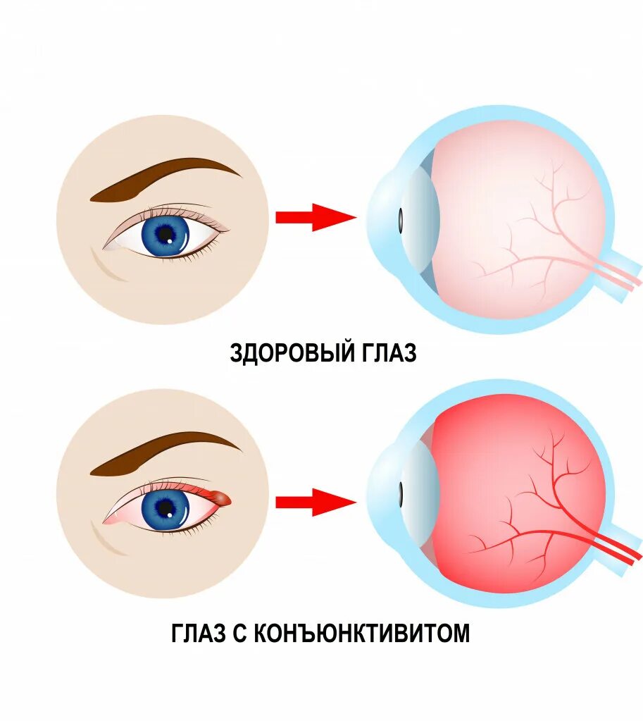 Лук жжет глаза. Лук жжет глаза