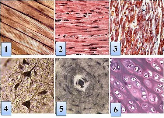Ксилема микрофотография. Фактуры под микроскопом. Соединительные ткани хрящ межклеточное вещество. Какой тип ткани изображен на микрофотографии. Костная ткань микропрепарат.