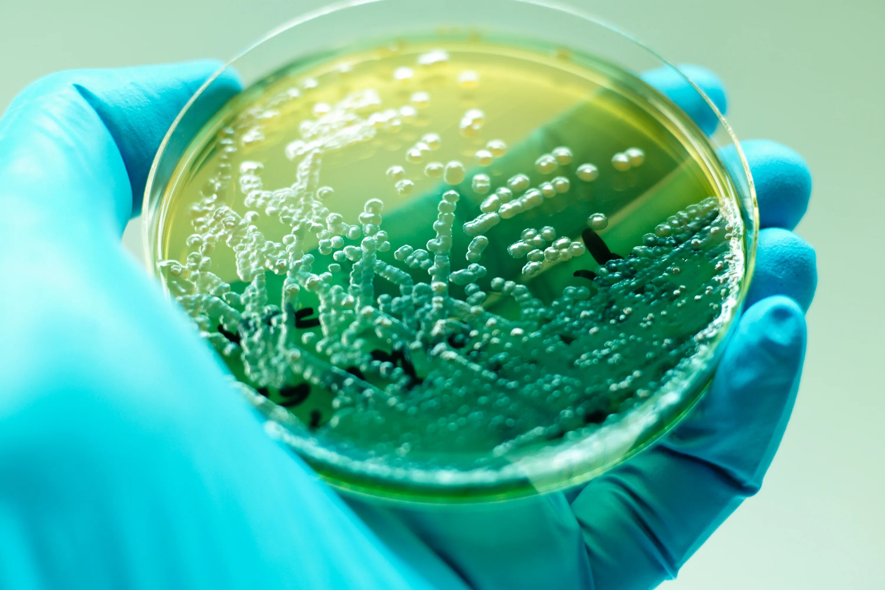 Синегнойная палочка в чашке Петри. Псевдомонада aeruginosa. Pseudomonas aeruginosa (синегнойная палочка). Pseudomonas aeruginosa микробиология. Бактерия синегнойная палочка