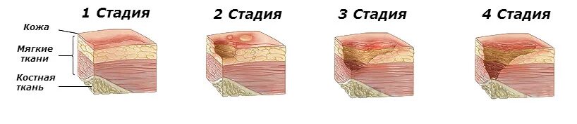 Как долго заживает разрез