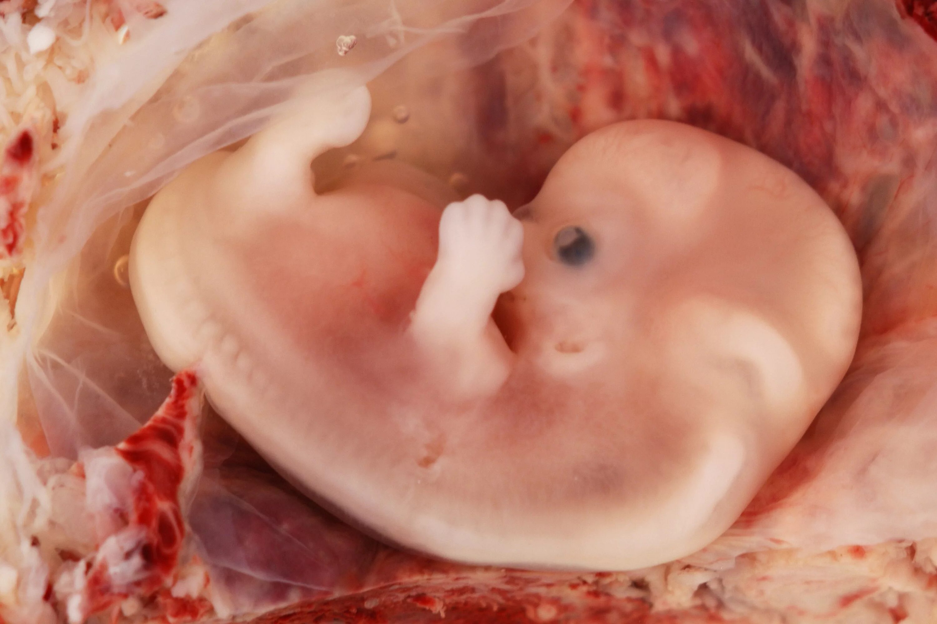 Эмбрион на 8 неделе беременности. Фото 8 недель беременности фото плода. Плод на 8 неделе беременности.