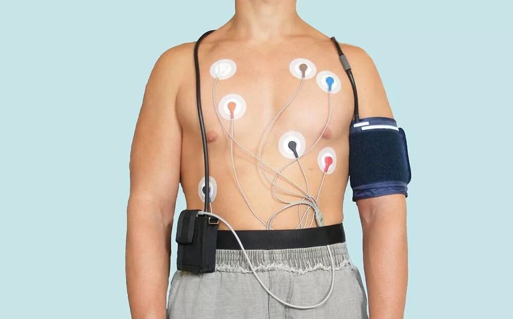 Холтер кусто. Аппарат холтер экг суточный. Суточное мониторирование экг и ад. Холтер монитор экг se-2012. Суточный мониторинг сердца.