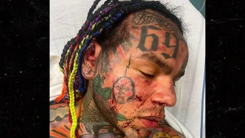 Tekashi 6ix9ine left bruised and bloodied after ambush attack inside gym sa...