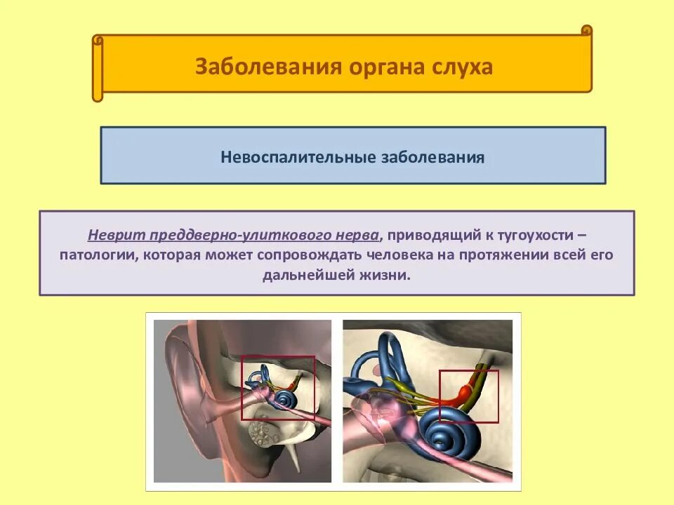 Болезни органов слуха. Нарушение органа слуха. Патология органов слуха. Причины заболевания органов слуха.