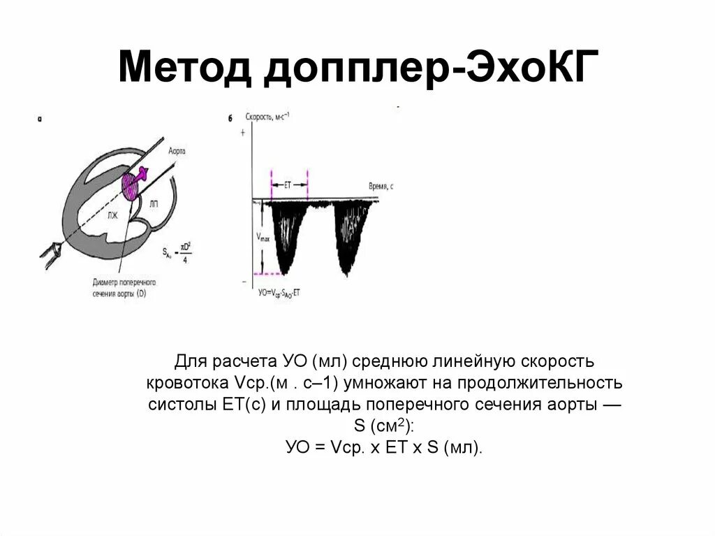 Доплер это во время. Эхокардиография принцип метода. Допплер ЭХОКГ. Методика ЭХОКГ. Доплеровский режим ЭХОКГ.