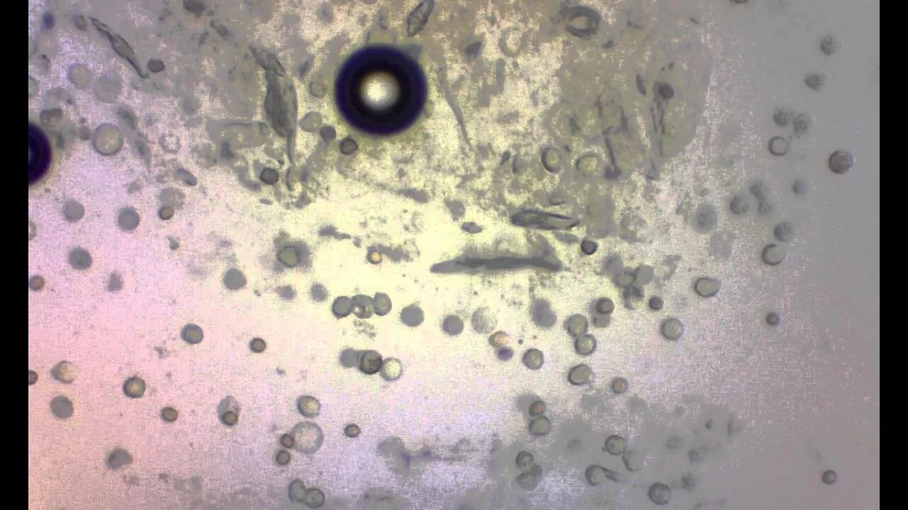 Бактерии в слюне. Сопла под микроскопом. Микробы в соплях под микроскопом.