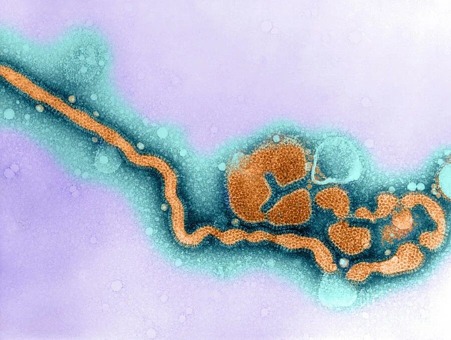 Вирус гриппа микрофотография. Электронная микрофотография вируса гриппа а. Вирус гриппа типа c. Вирус гриппа б. Kinito pet вирус