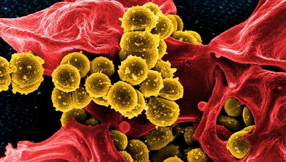 Staphylococcus aureus иммунитет. Золотистый стафилококк под микроскопом. Золотой стафилококк под микроскопом.