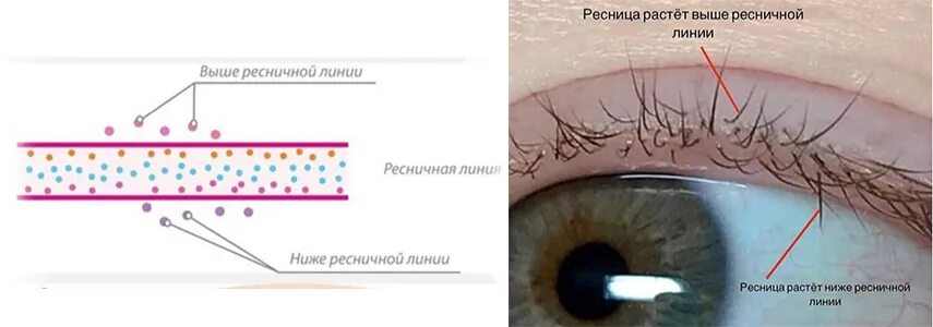 Отличные результаты с кондиционером для роста бровей Cherisher "Cherish Brow" и 