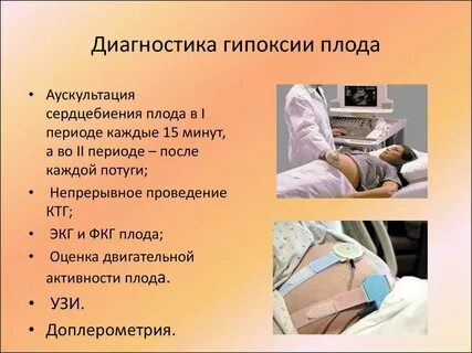 Гипоксия 37 недель