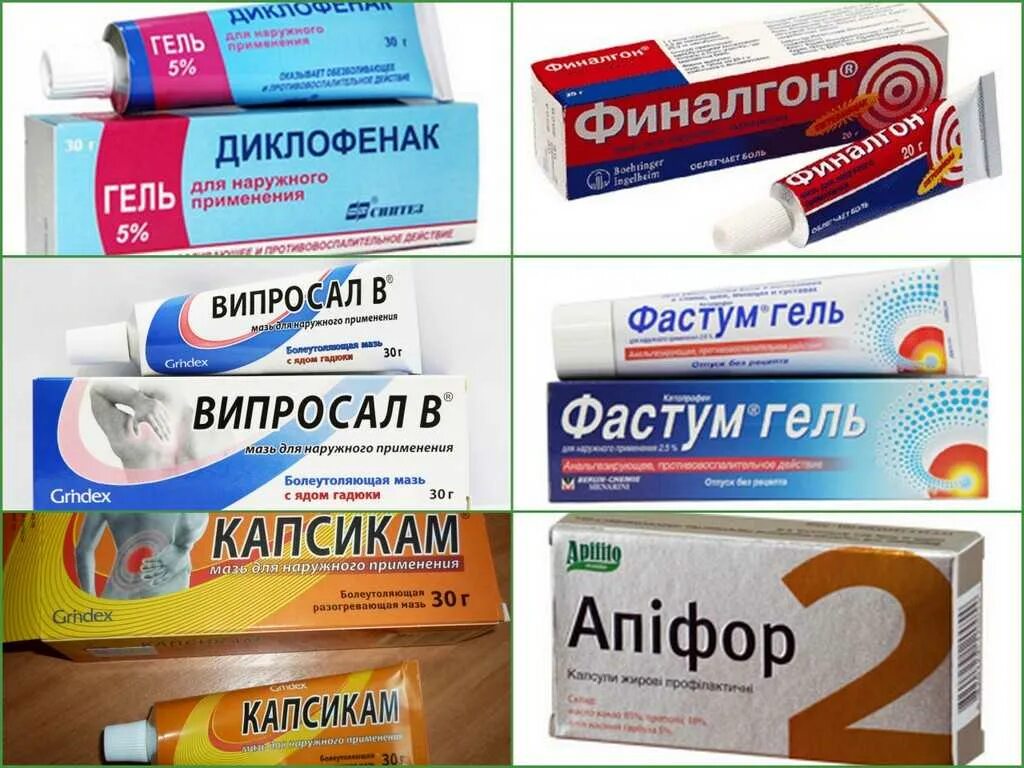 Артроз лекарства и препараты. Мази обезболивающие для суставов при артрозе. мази и гели при артрите. мазь от воспаления суставов.