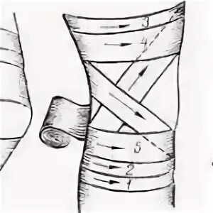Как перевязывать колено. Бинтование коленного сустава эластичным бинтом. Бинтование коленного сустава эластичным бинтом восьмеркой. Бинтование колена эластичным бинтом при травме. Перевязка коленного сустава эластичным бинтом.