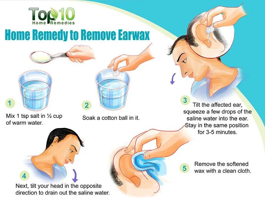 Earwax removal. Как правильно мыть уши. Чистка ушей в домашних условиях.