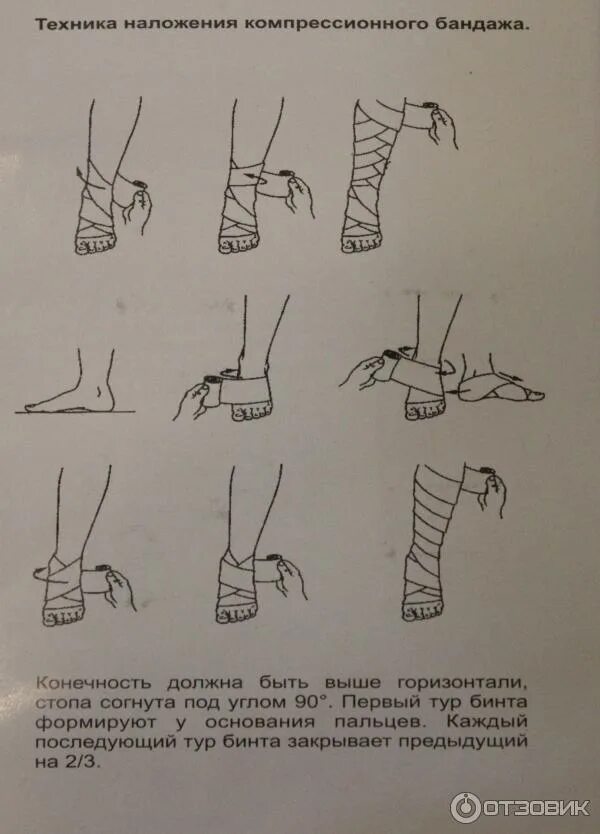 Техника наложения эластичного бинта