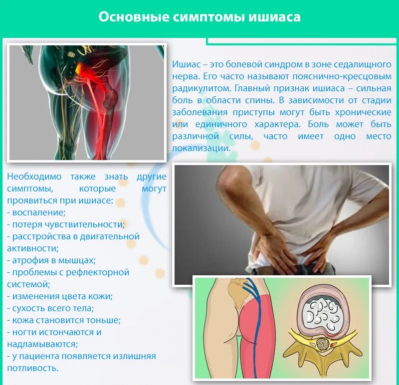 Симптомы боли седалищного нерва у мужчин. Седалищный нерв защемление симптомы мазь. УВЧ терапия седалищного нерва. Невропатия седалищного нерва симптомы. Ишиас тазобедренного сустава симптомы.