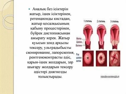 Тұратын куннилингус бейне