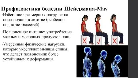 Болезнь шейермана по утвержденным