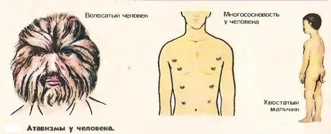 К атавизмам относятся. Атавизм и рудимент копчик. Рудименты человека многососковость.