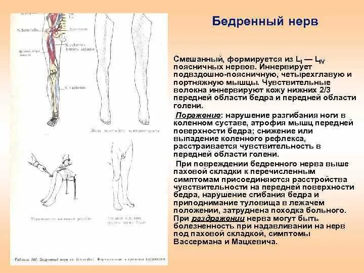 Невропатия наружная бедра. Симптомы характерные для поражения бедренного нерва:. Парез бедренного нерва симптомы. Клиника поражения бедренного нерва. Бедренный нерв симптомы поражения.