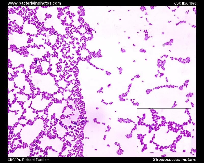 Стрептококк мытный это. Стрептококк мутанс микробиология. streptococcus mutans gram. кариесогенные стрептококки микробиология. стафилококк фуксин.