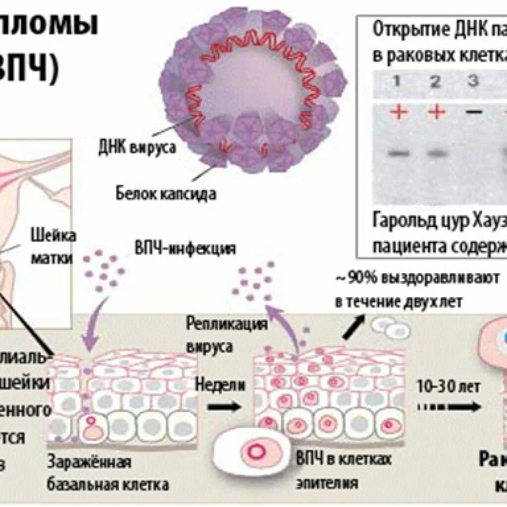 Папиломы вирус передается от человека к человеку. Папилломавирусная инфекция вирус. Вирус папилломы кондиломы.