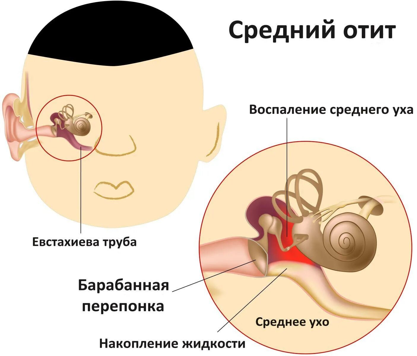 Что делать если сильно болит ухо внутри