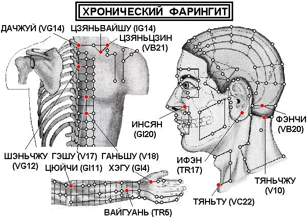 Акупунктурные точки при ангине. Точки от боли в горле. Точки на руках от простуды. Акупунктурные точки бальзам звездочка. Точки акупунктуры при ангине.