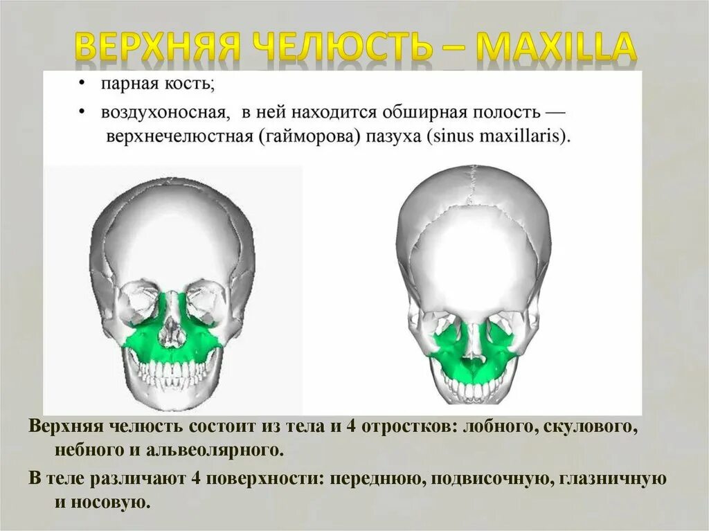 Верхняя челюсть воздухоносная кость. Кости черепа верхняя челюсть. Лицевой отдел черепа верхняя челюсть. Воздухоносные кости лицевого отдела черепа. Парной костью являются