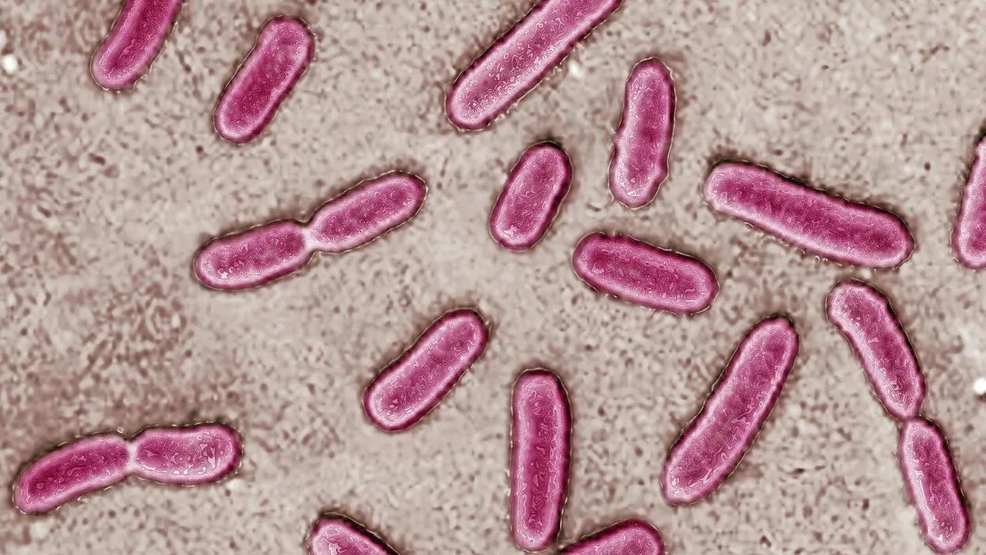 Бактерия Pseudomonas aeruginosa. Pseudomonas aeruginosa микроскопия. Псевдомонас ауреофациенс. Pseudomonas putida в микроскопе.