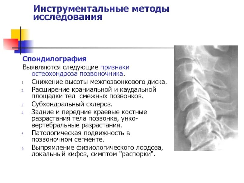 Склероз замыкательных пластинок позвоночника. Субхондральный склероз замыкательных пластинок тел позвонков th4-th9. Снижение высоты тела позвонка. Снижение высоты межпозвонковых дисков. Остеохондроз рентгенологические признаки.