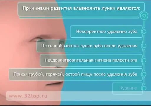 Можно Купить После Удаления Зуба - Vsyo-so-skidkoj.ru