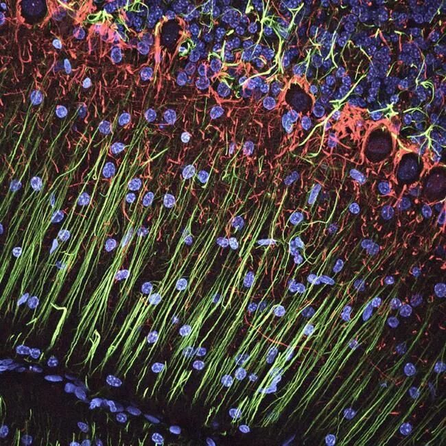 Спинномозговой нерв микроскоп. Мозг под микроскопом. Ткань мозга под микроскопом. Нервные клетки сеть нейронов микрофотография. Мозг под микроскопом.