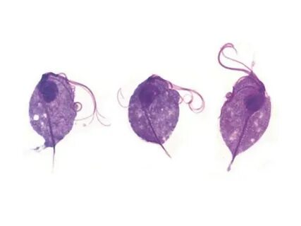 Trichomonas vaginālis