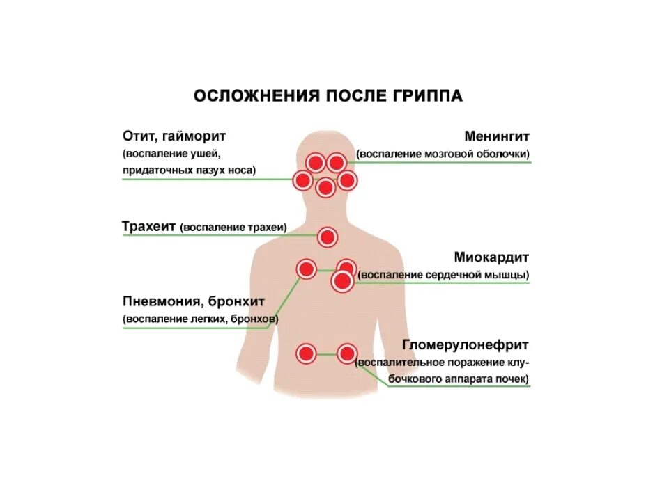 Какие могут быть осложнения. Осложнения вирусных инфекций. осложнения орви. осложнения гриппа. наиболее частые осложнения гриппа.
