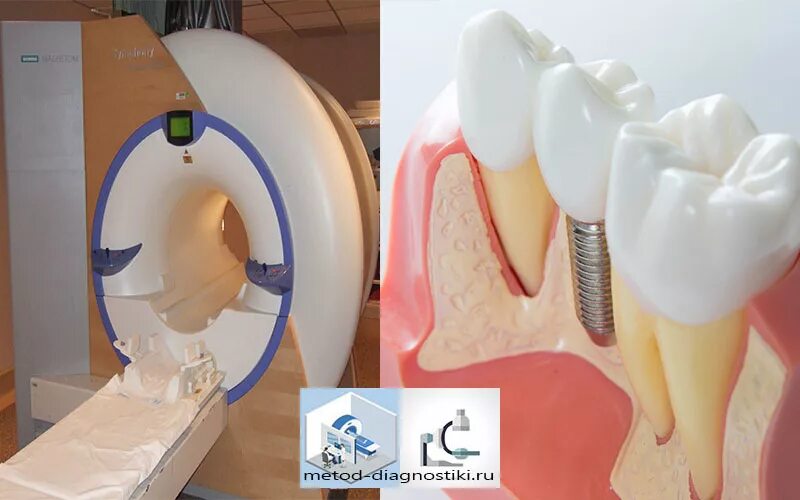Можно ли с зубным имплантом делать мрт. Томограф зубов. Мрт с зубными имплантами.