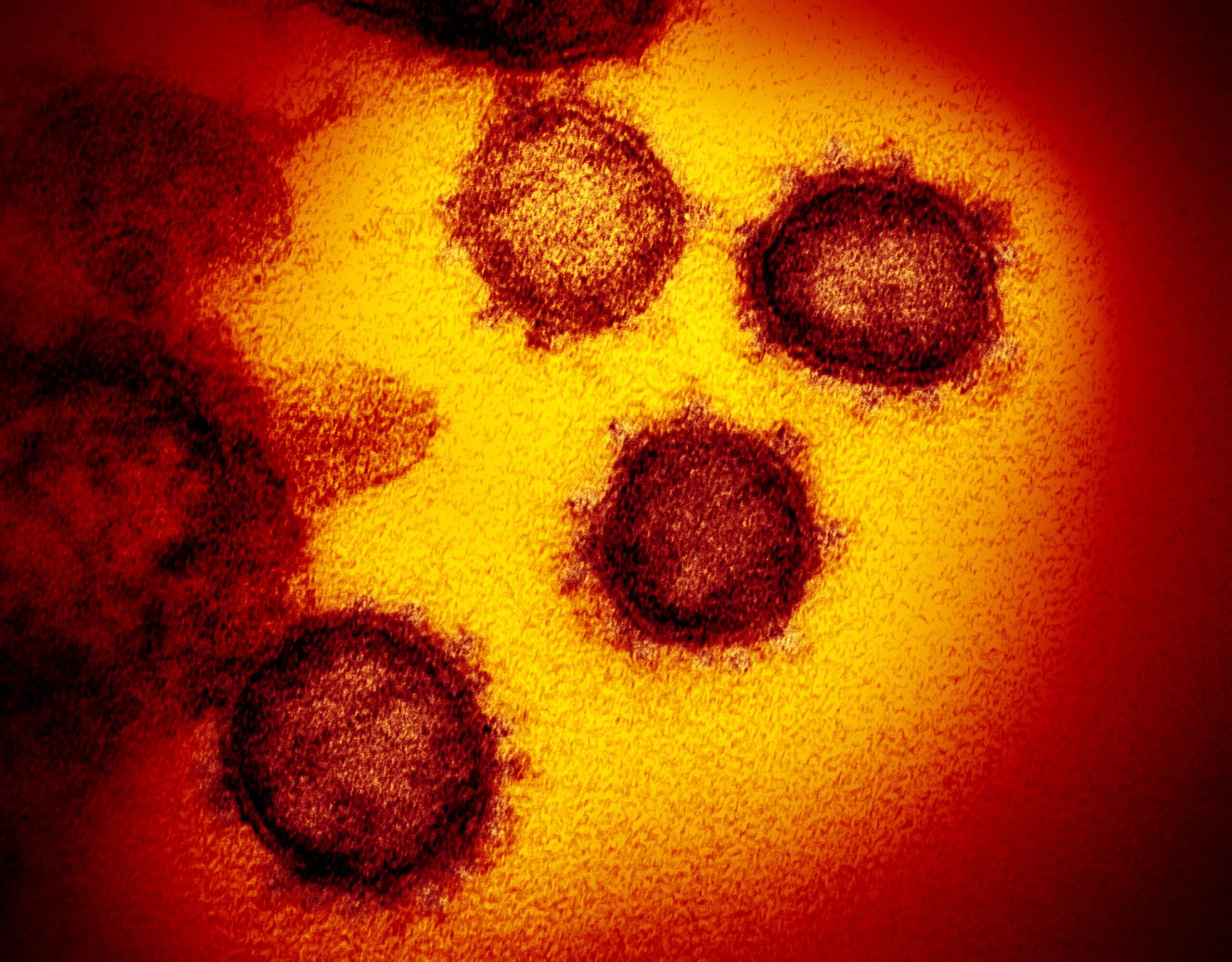 Коронавируса более. Вирус Covid 19 под микроскопом. Вирус коронавируса под микроскопом. Вирус SARS-cov-2 под микроскопом. Covid-19 микроскоп.