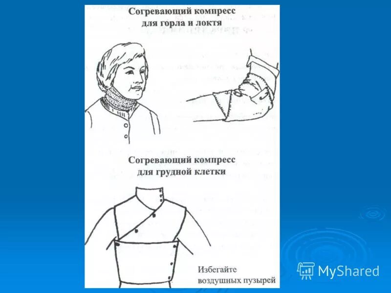 можно ли ставить компресс на горло