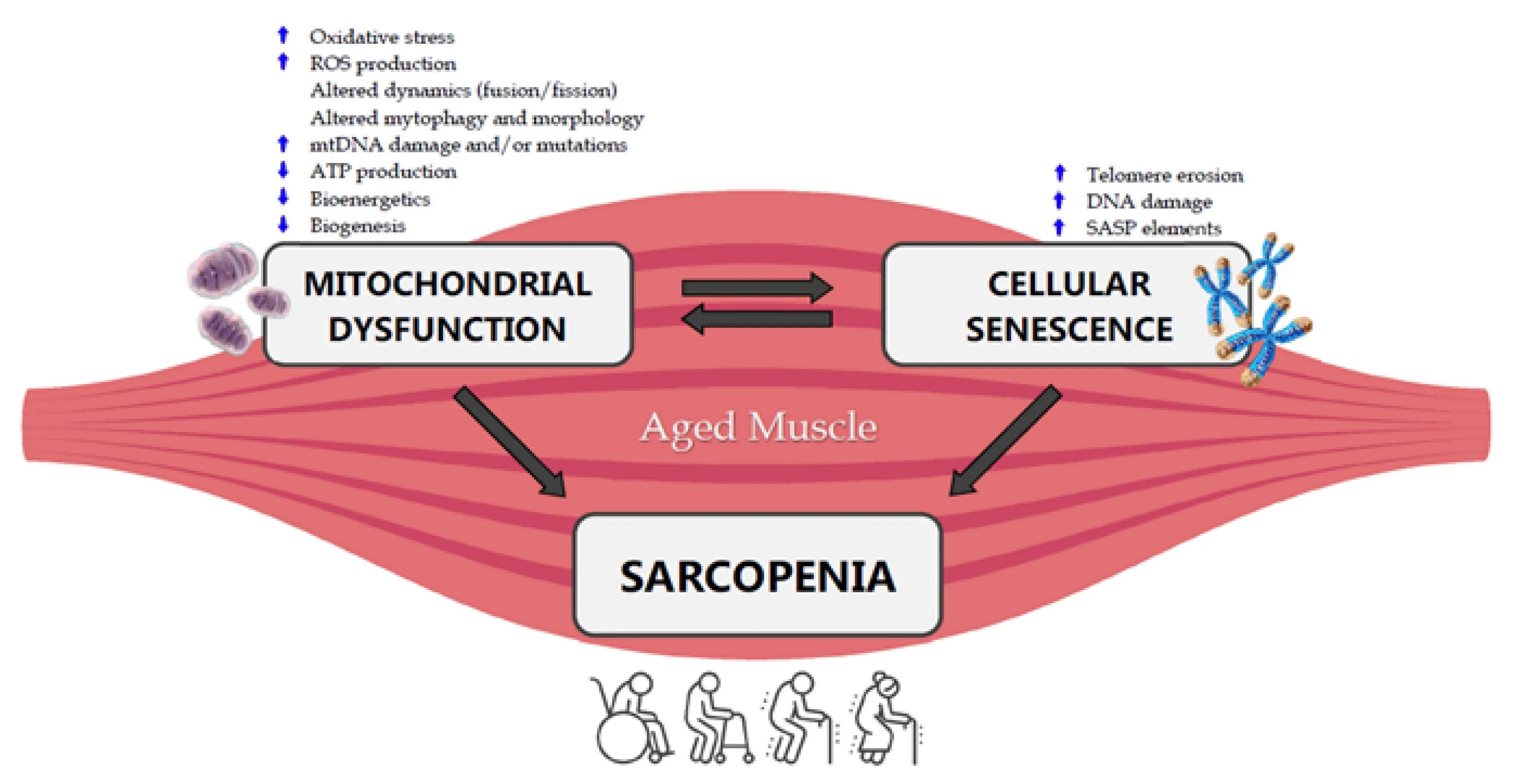Саркопения лечение отзывы. Патогенез саркопении. Саркопения мышцы. Механизм развития саркопении. Старческая саркопения.