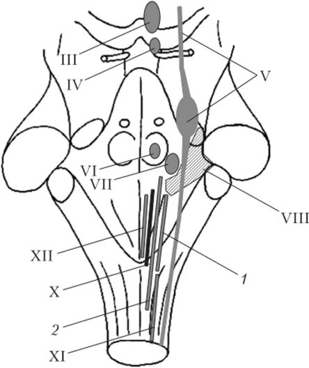Ромбовидная ямка черепные нервы. Ромбовидная ямка ядра черепных нервов. Ядра черепных:нервов 4 желудочек. Проекция ядер продолговатого мозга. Проекция ядер на ромбовидную ямку.