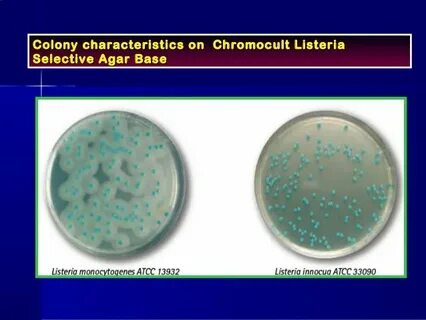 Методы выявления бактерий listeria monocytogenes