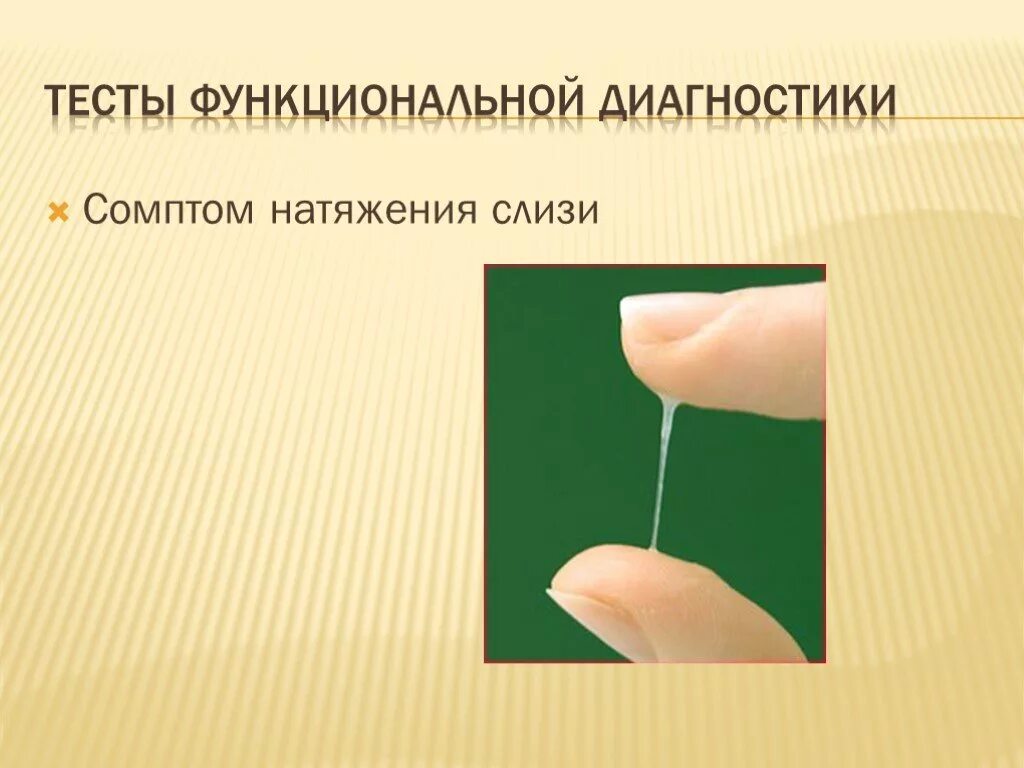 Слизь как белок. Натяжение шеечной слизи. Синдром натяжения шеечной слизи. Симптом растяжения цервикальной слизи. Изменение натяжения шеечной слизи.